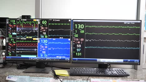 Nahaufnahme-Von-Monitorbildschirmen,-Die-Den-Gesundheitszustand-Von-Covid-19-infizierten-Patienten-Zeigen