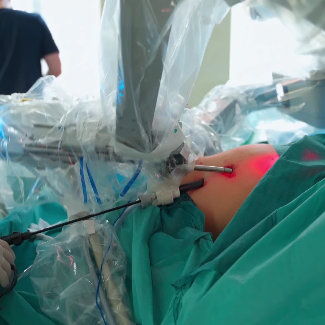 Surgeon performing robotic surgery. Doctors using surgery robot in surgical room in hospital with robotic technology equipment