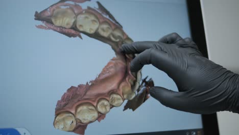 doctor scans the patient's teeth in the clinic. the dentist holds in his hand a manual 3d scanner for the jaw and mouth. dental health. creates a 3d model of teeth and gums on a medical monitor.