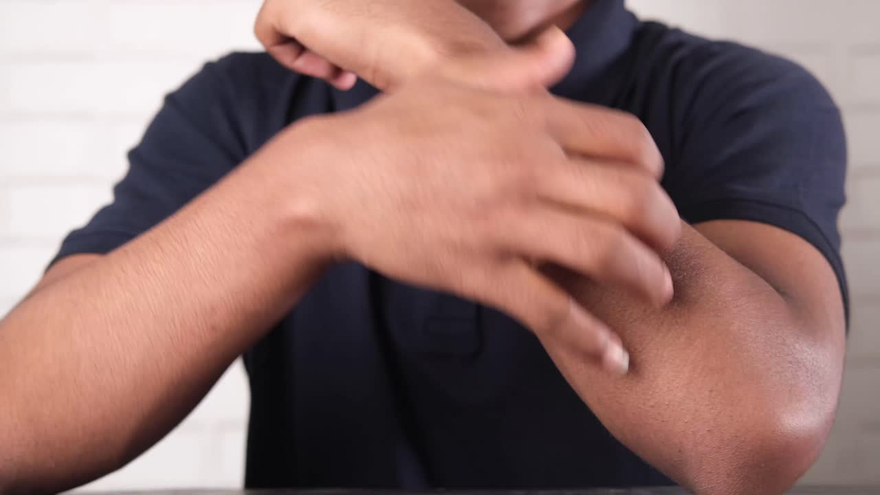 손가락 가려움증