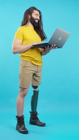 man with prosthetic leg using laptop