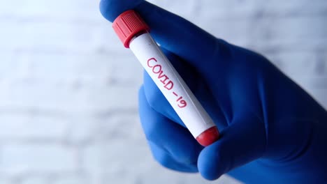 covid-19 blood test sample