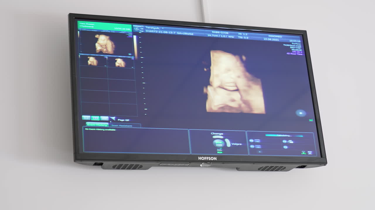 Ultrasound baby in a mother's womb. Ultrasound of pregnant woman. Scientific analysis