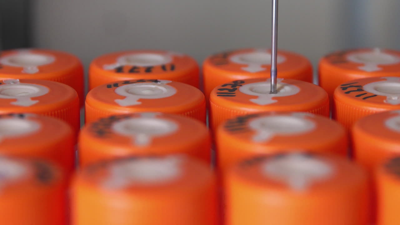 살균 된 의료 실험실 기계의 클로즈업은  ⁇ 크 분석을 통해 암을 탐지 할 때 자동으로 분석을 수행합니다.