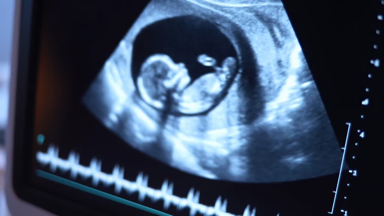 Primo piano di un monitor ecografico che mostra un feto, ripreso di lato, in un video medico.