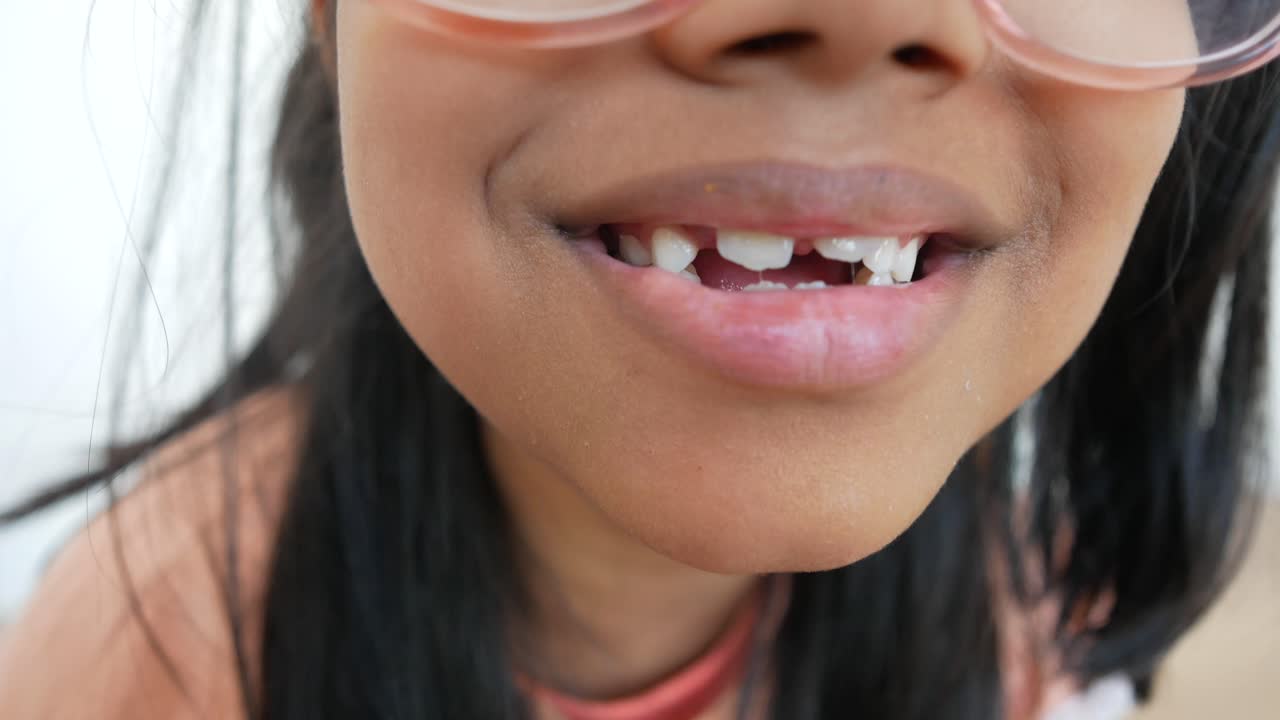 이빨이 없는 아이