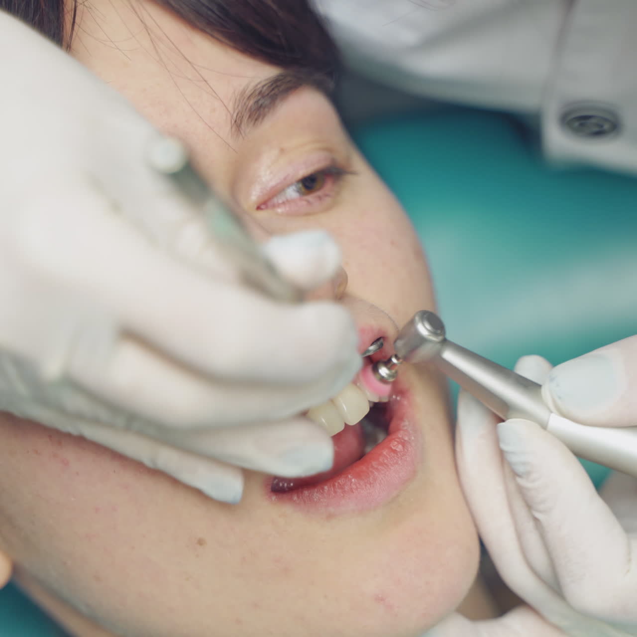 Professional dentist working with patient at dental office. Air flow method of cleaning teeth with sandblasting machine. Close-up