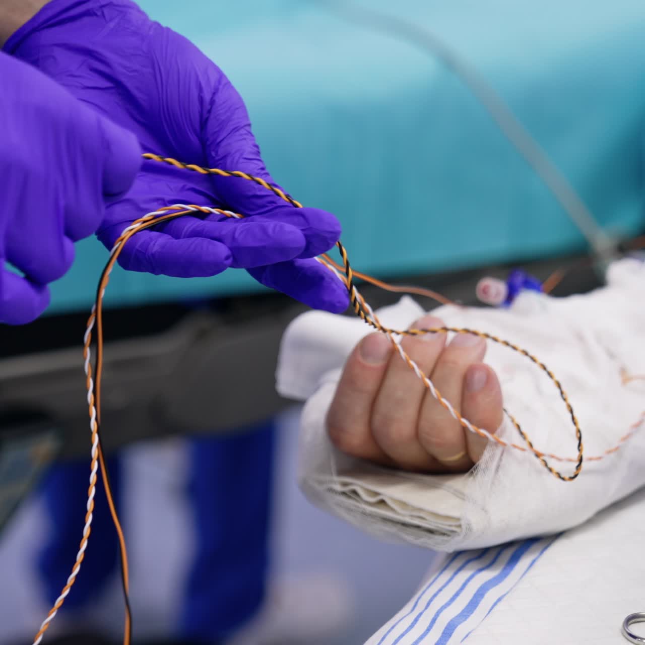 Attaching the patient to the neuromonitoring equipment. Gloved hands untangle the wires near patient's hand