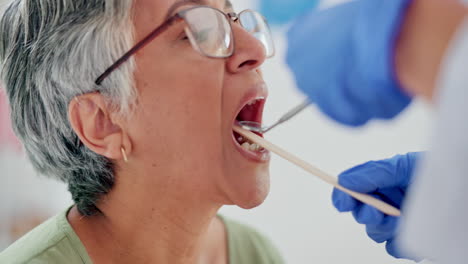 Dentist,-woman-and-dental,-teeth