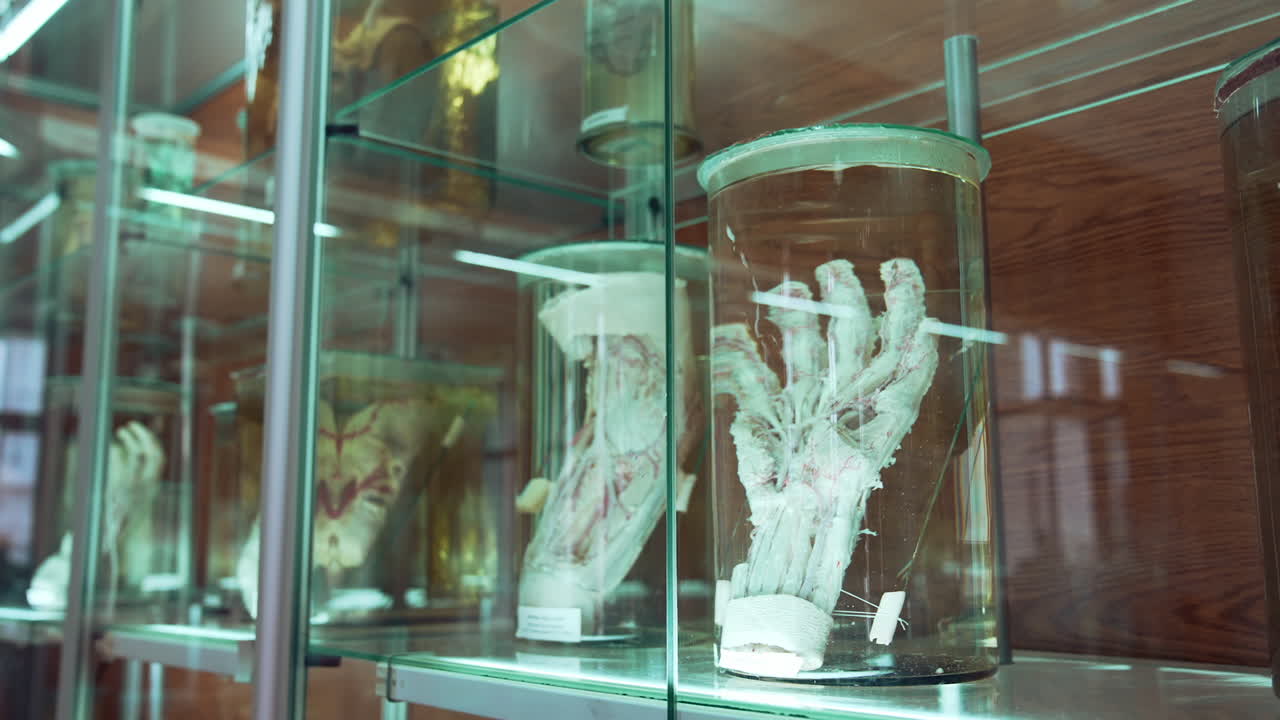 Human organs in museum. Human organs in formalin in anatomical museum