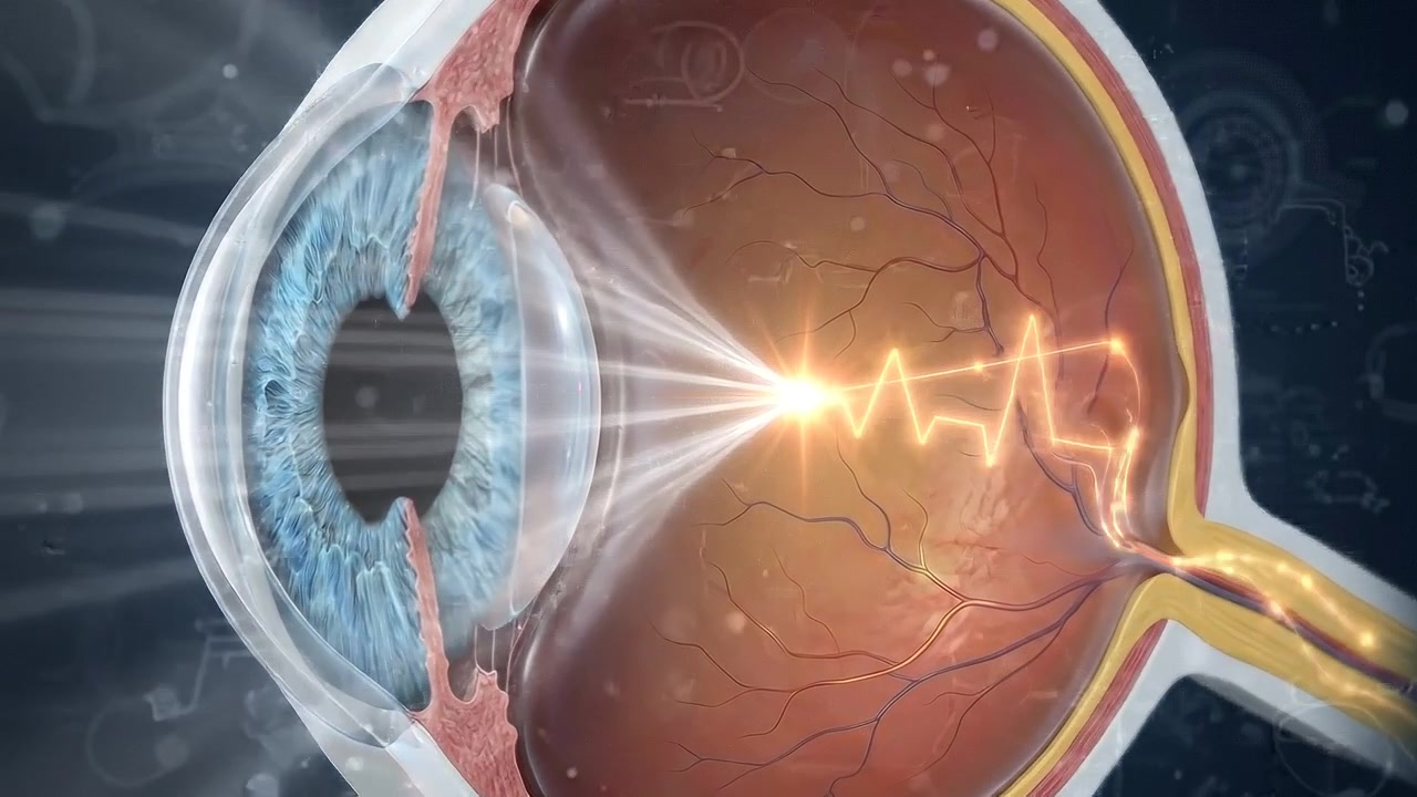 Sezione trasversale dell'occhio umano che mostra retina, cristallino e nervo ottico in prospettiva medica