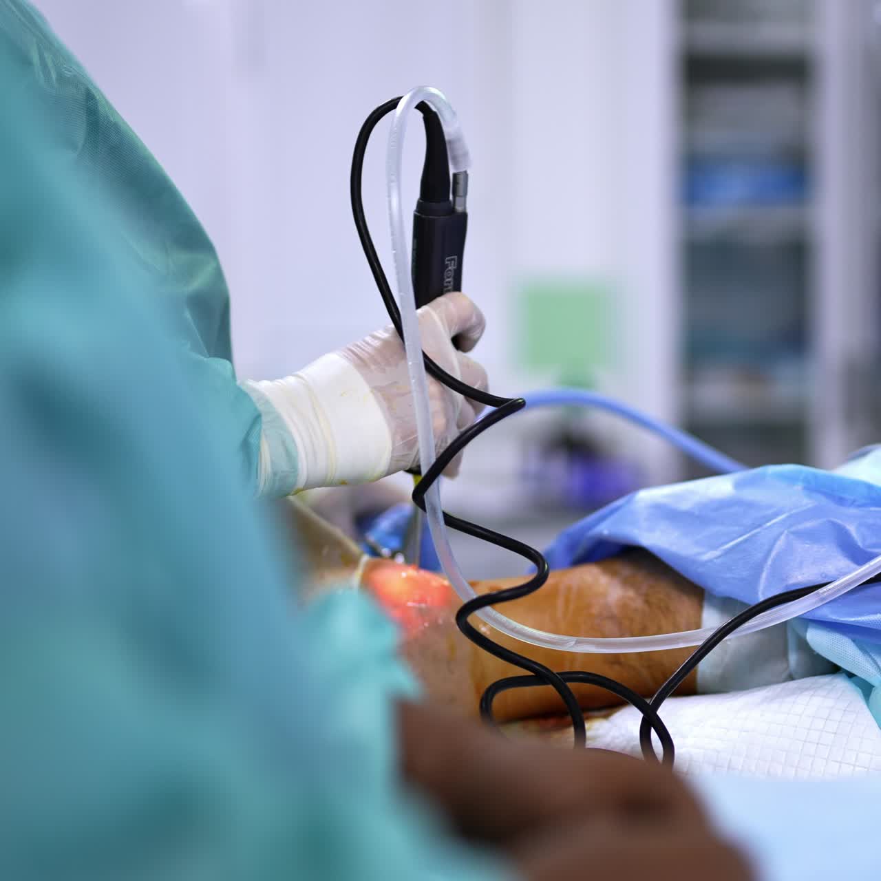 Doctor carefully moves the device input into the cut in patient's leg. Using modern technology at surgical operation. Blurred backdrop