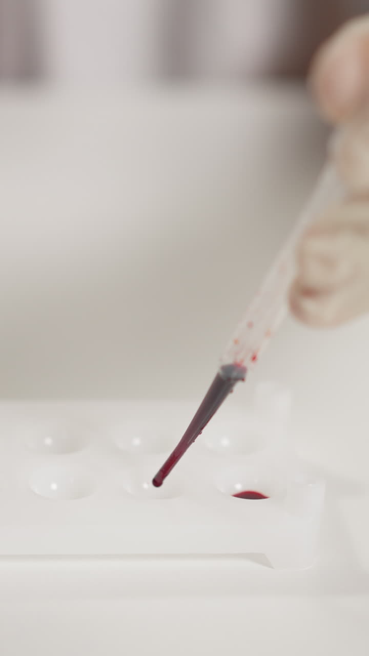 Lab assistant in rubber gloves drips blood into well plate with plastic pipette conducting medical tests in hospital laboratory closeup