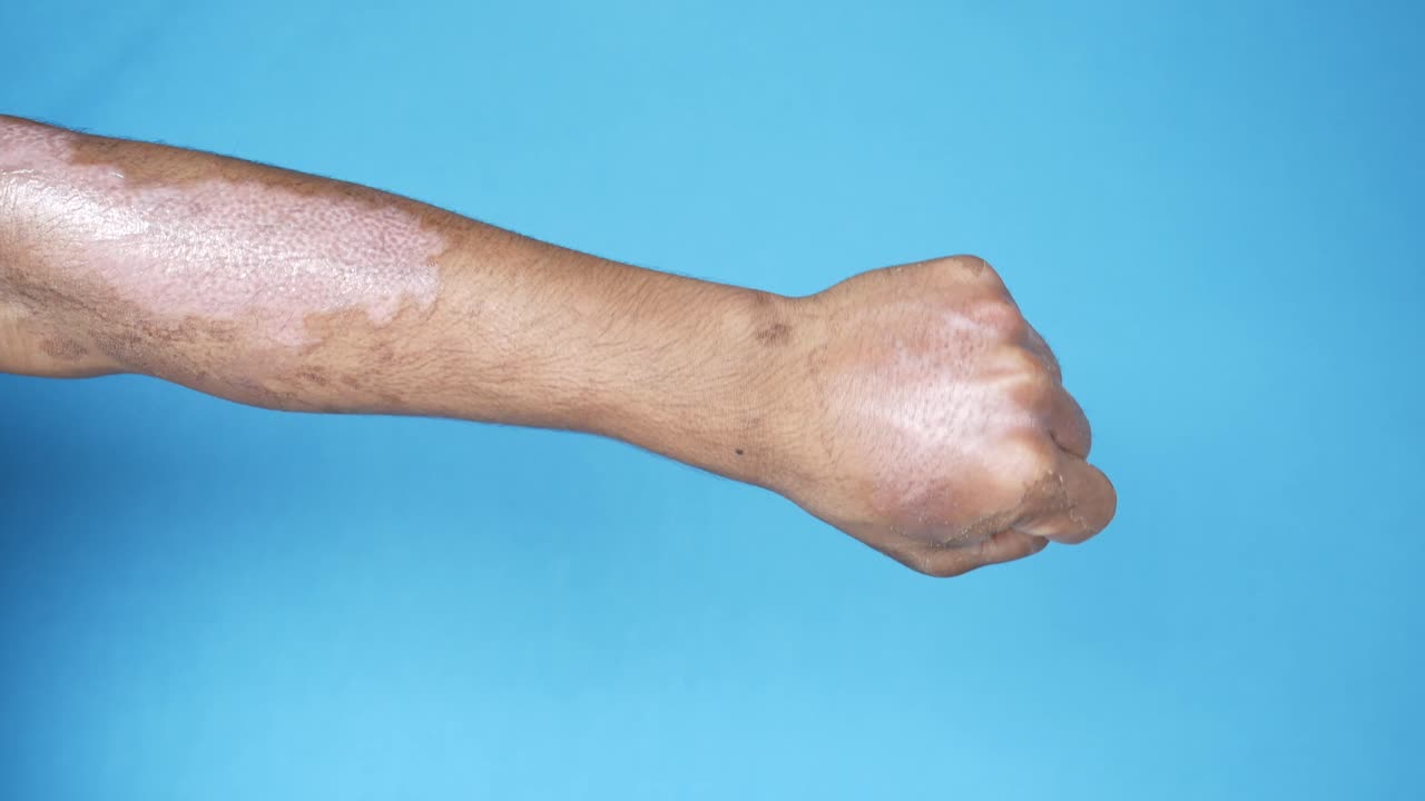 팔과 손의 피부 상태