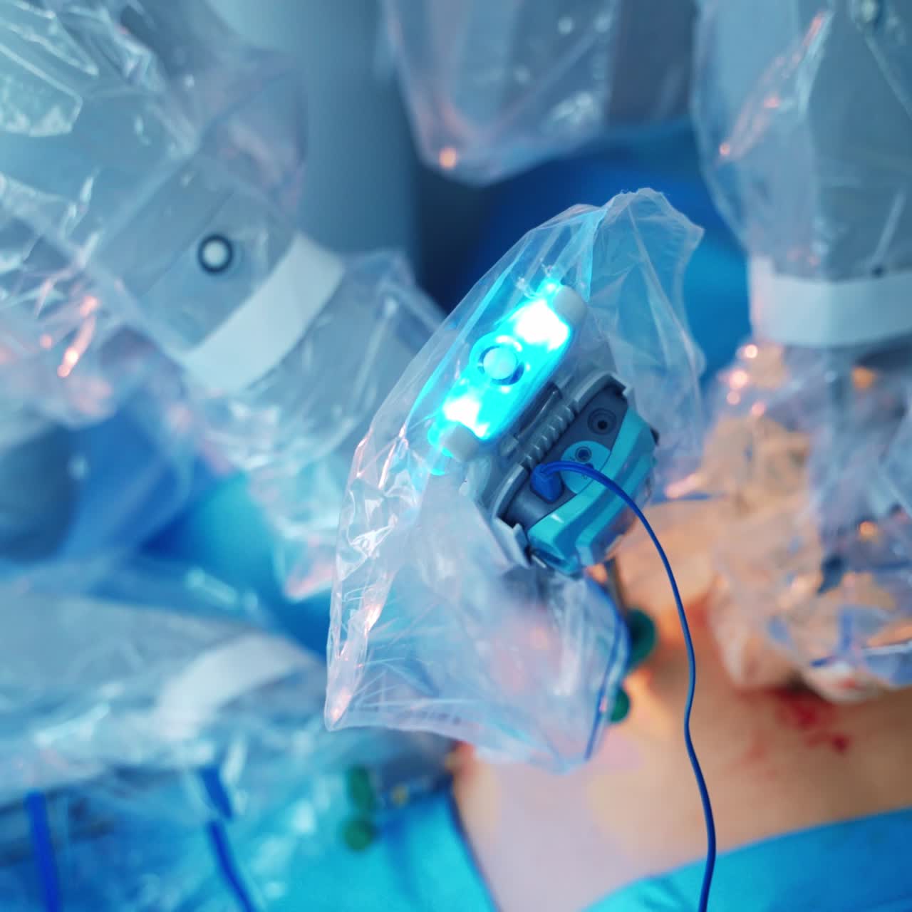Robotic equipment doing surgery. Complicated operation with modern medical robot performing on a patient. Close-up.