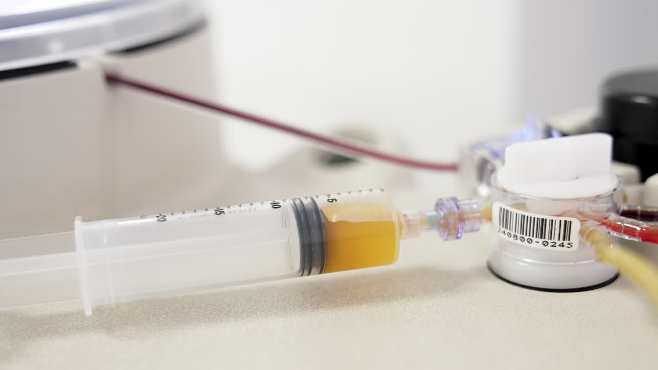Yellow plasma separated from blood filling the syringe. Close up. Equipment preparing concentrate for prp therapy.
