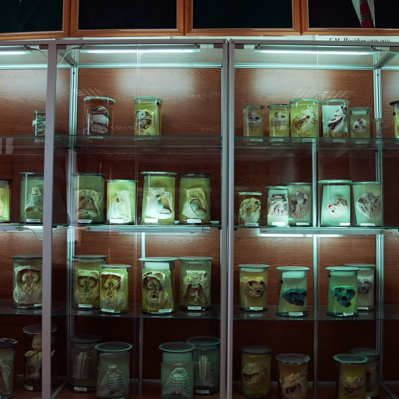 Large collection of human organs in anatomical museum. Different parts of internal organs preserved in formaldehyde on shelves. Scientific education