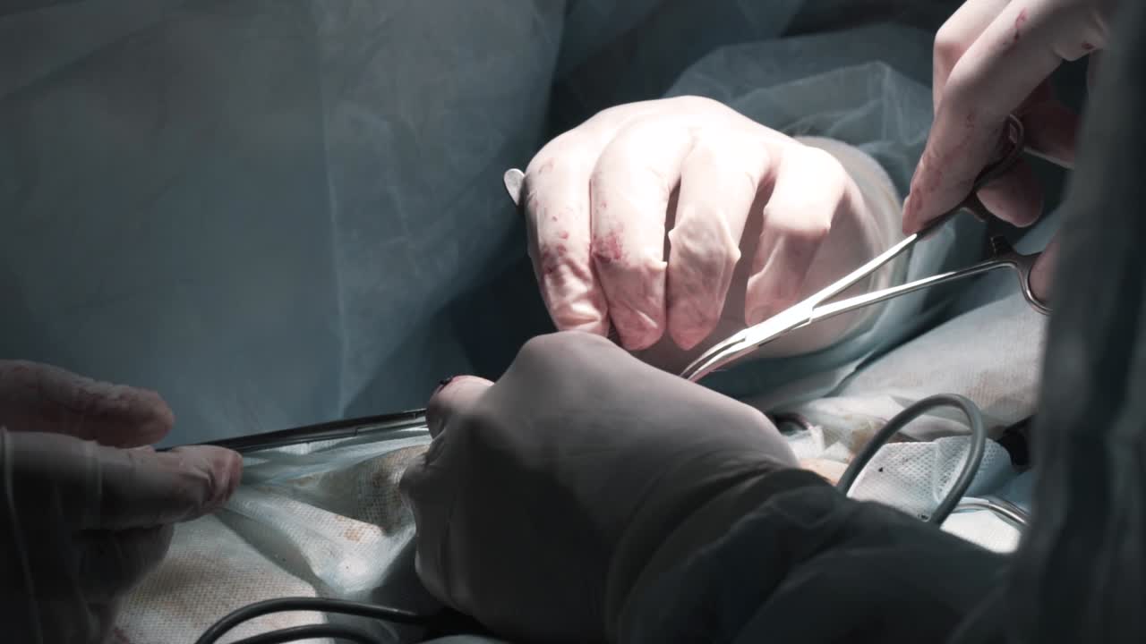 procedimiento quirúrgico