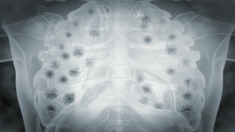 Rayos-X-Del-Sistema-Respiratorio-Infectado-Por-Virus-Peligroso