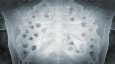 x- ray of respiratory system infected by dangerous virus