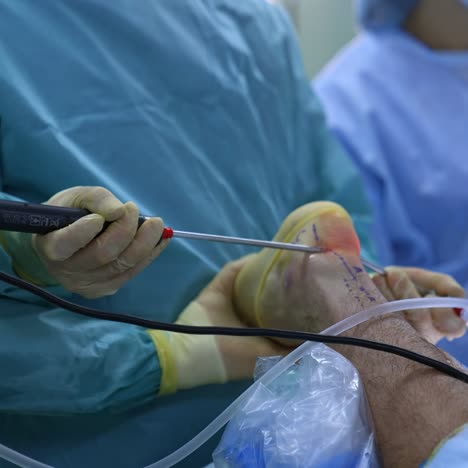 successful teamwork of medical team. close up shot in the operating room