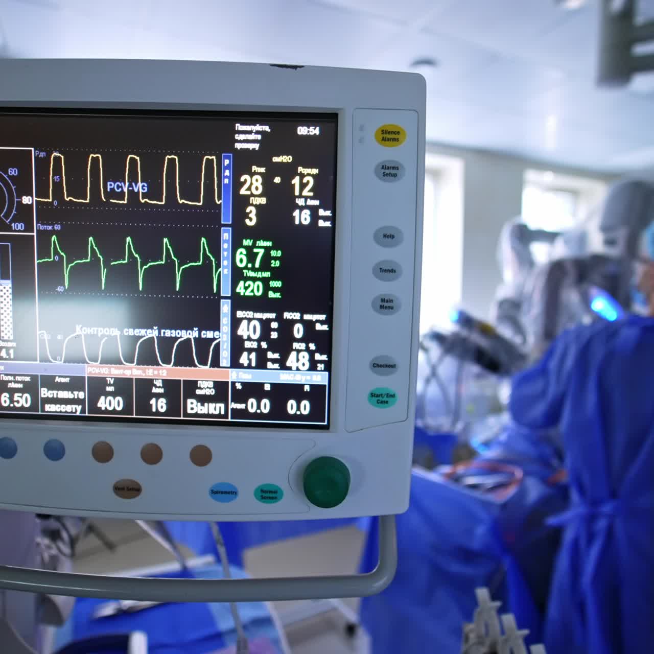 Schermo nero con curve mutevoli dei parametri vitali. Operazione condotta da attrezzatura robotica Da Vinci sullo sfondo