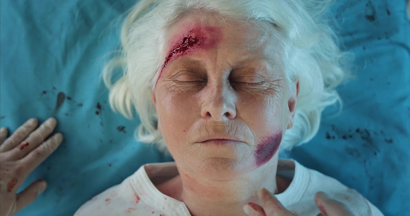 Kritisk tilstand for eldre kvinne med hodeskade og oksygenmaske.