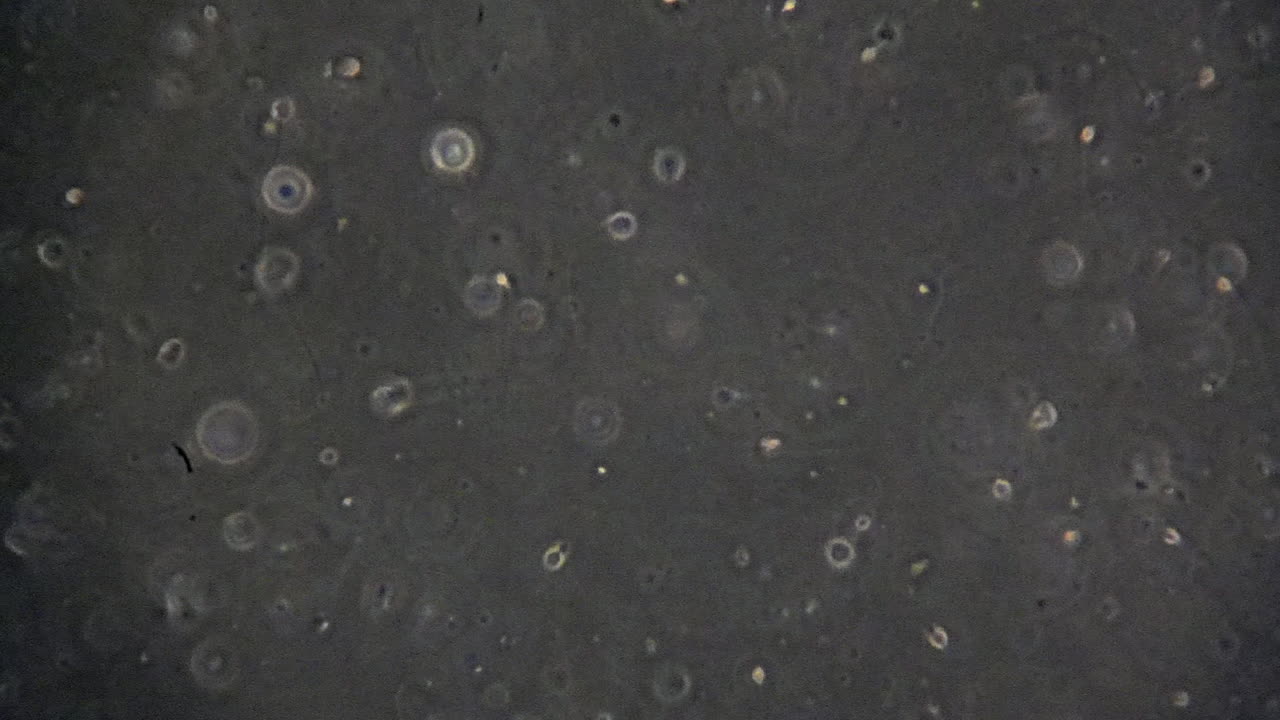 el microscopio se centra en las células espermáticas humanas.