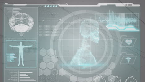 animation of network of connections over human brain and medical data processing on screen