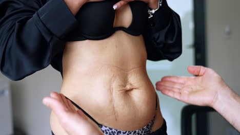 unrecognized caucasian female with loose skin and scar on the belly having consultation at doctor's office. close up. surgeon points at problematic areas and discusses future plastic surgery.