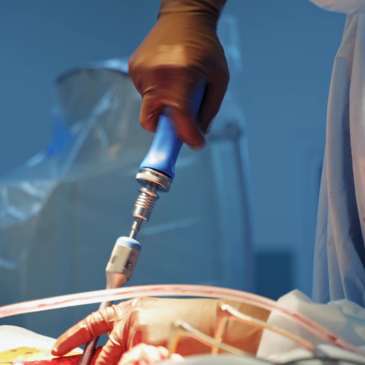 Doctor during surgery in operating room. Professional doctor performing operation in surgery room