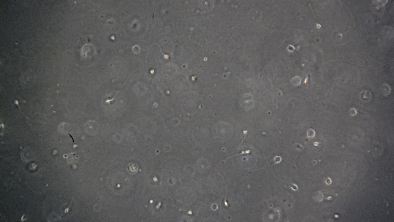 células espermáticas humanas vistas a través de un microscopio de contraste de fase