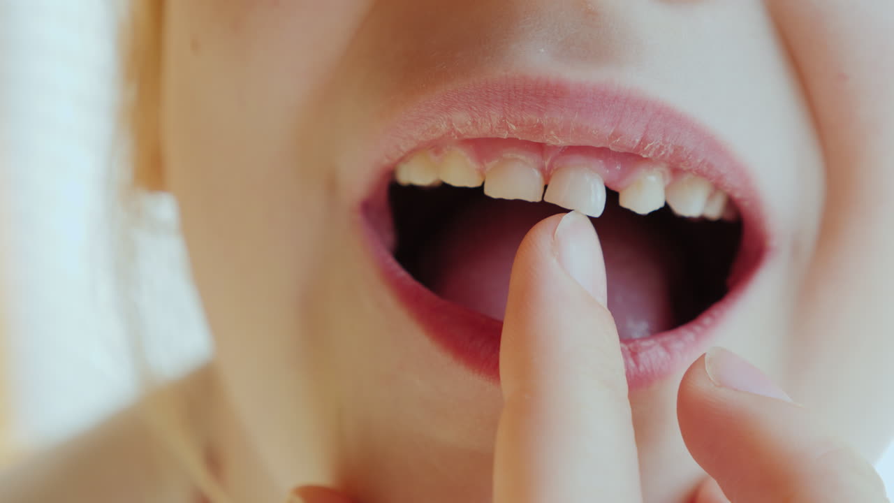 la niña está sacudiendo su dedo con un diente de leche que pronto se caerá