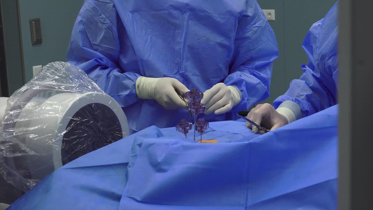 la vertebroplastia es un procedimiento en el que se inyecta un cemento especial en una vértebra fracturada, con el objetivo de aliviar el dolor de columna y restaurar la movilidad.