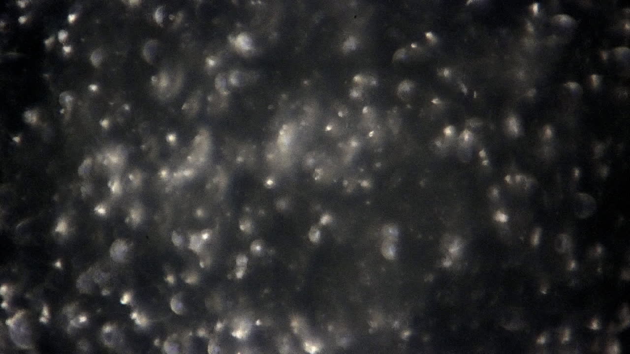 espermatozoides humanos con ajuste de enfoque