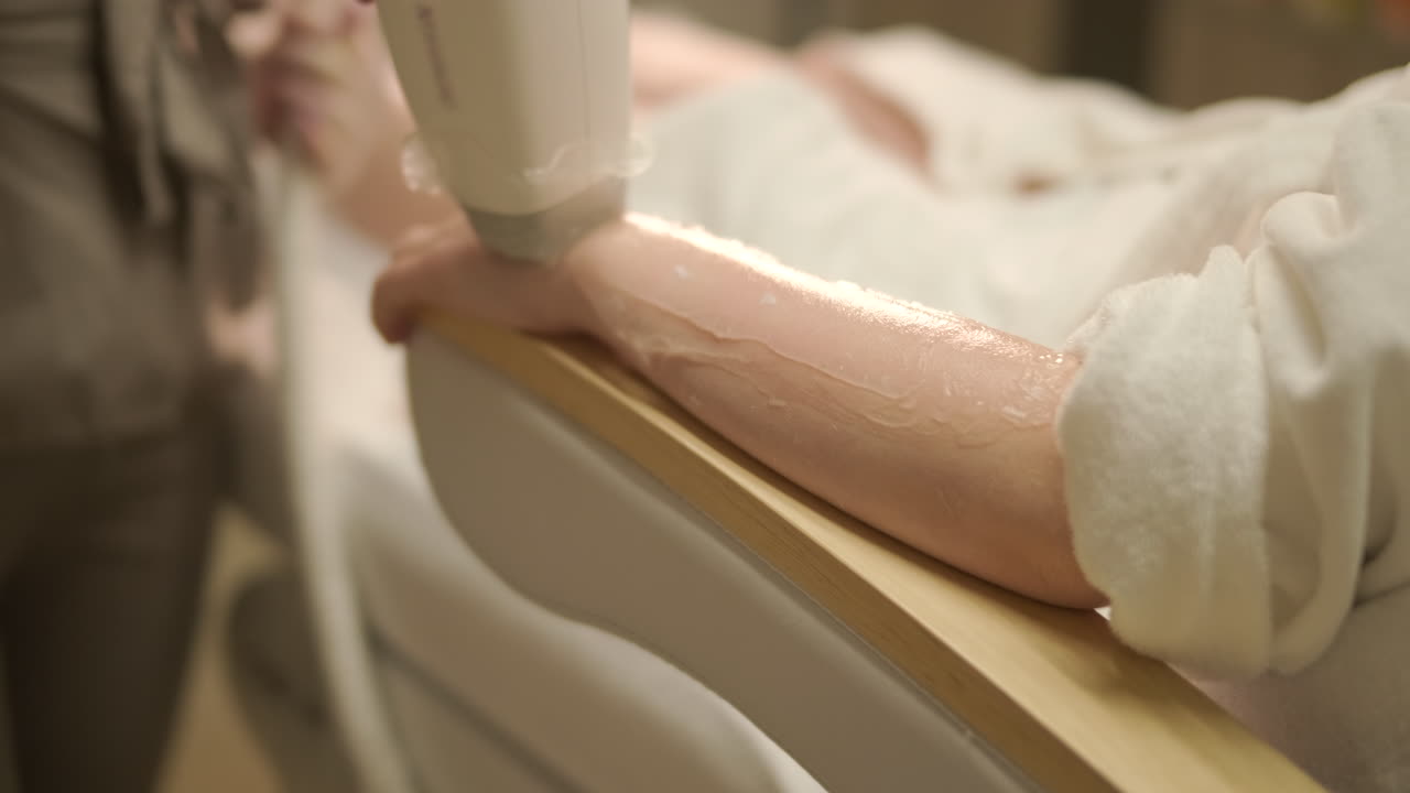 Close-up of Laser Hair Removal Treatment on Woman's Arm