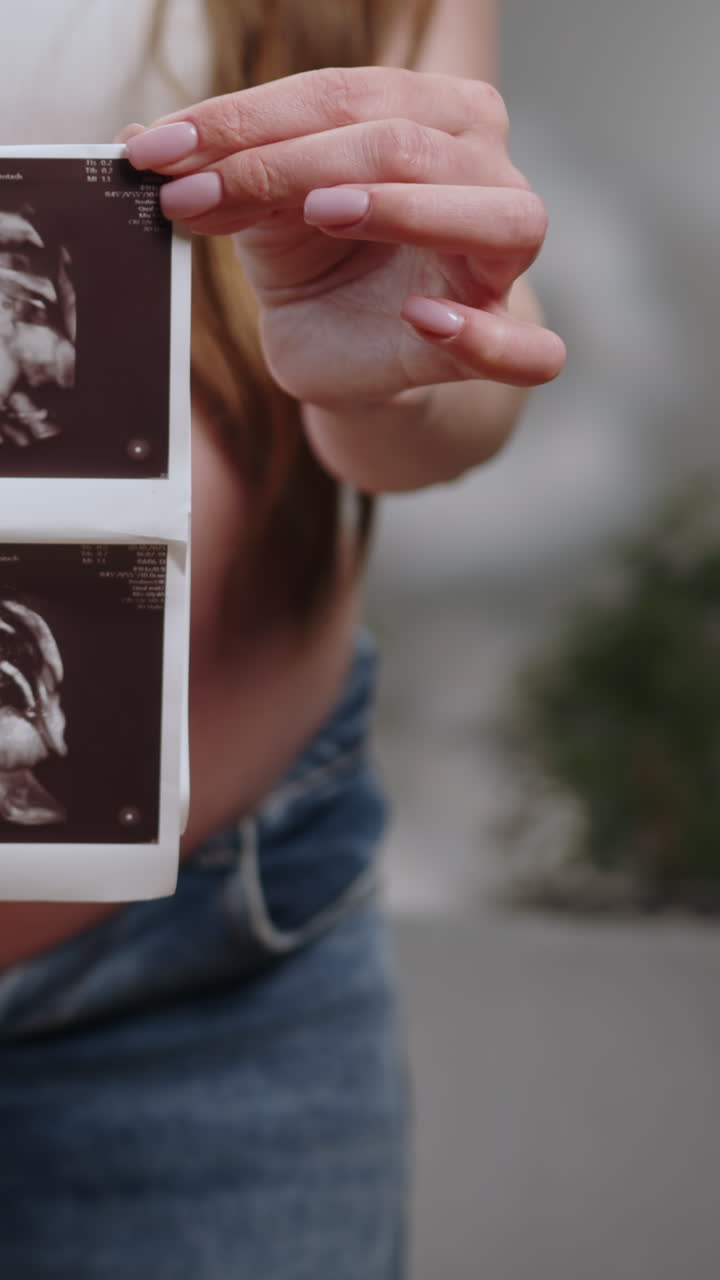 Donna incinta che mostra le immagini ecografiche del suo bambino, con evidente gioia e attesa