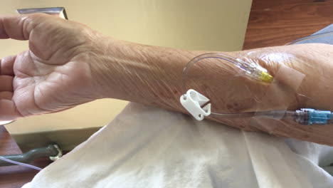 Senior-Female-Patient's-Arm-Close-Up-Having-Chemotherapy-Treatment-With-IV-Drip
