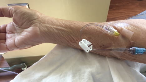 primer plano del brazo de una paciente mayor que recibe tratamiento de quimioterapia con goteo intravenoso