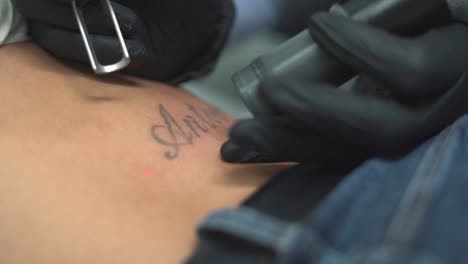 quitar el tatuaje de la mujer, borrarlo o borrarlo