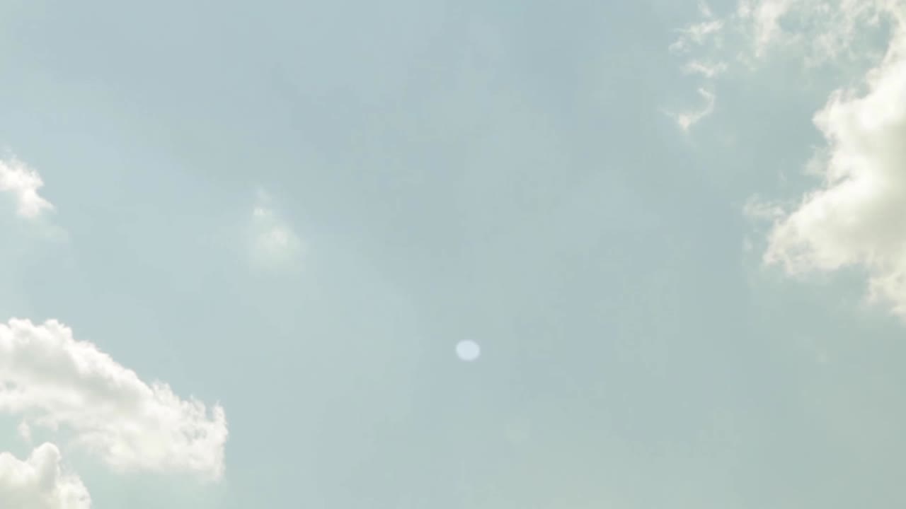 하늘의 구름을 올려다보며 어지러운 방향 감각 상실