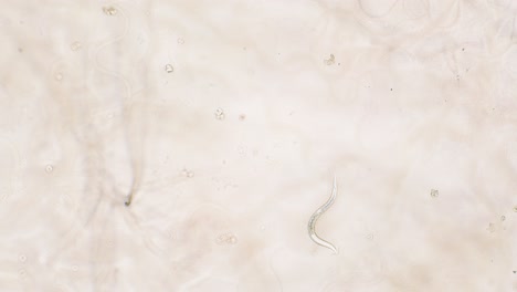 single nemotode moving in petri dish agar substrate