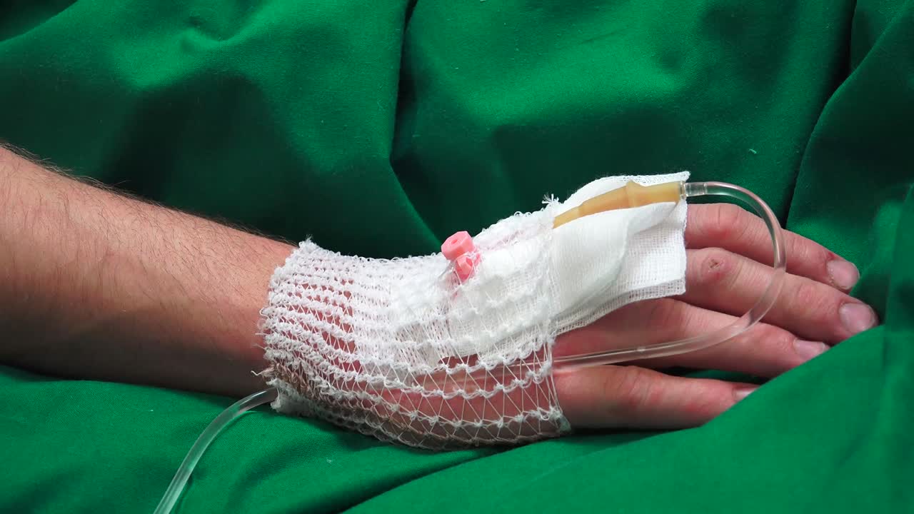 la terapia intravenosa es una terapia que administra líquidos directamente en una vena.