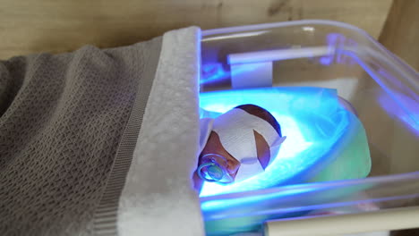 caucasian baby with protective bandage on eyes lies in a hospital crib. infant having a phototherapy from jaundice.
