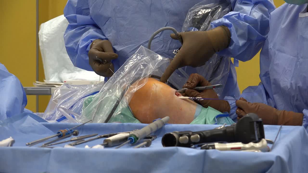 Anterior cruciate ligament reconstruction is a surgical tissue graft replacement of the anterior cruciate ligament, located in the knee, to restore its function after an injury