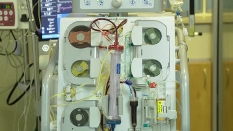 dialysis machine being used in a hospital - close up