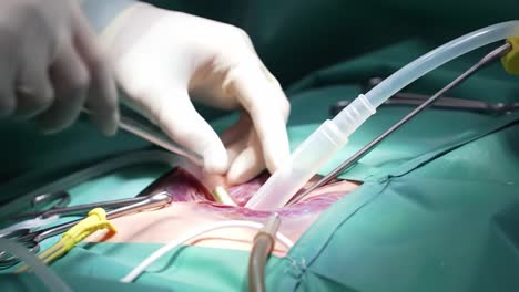 surgical procedure overview: focus on instrumentation and technique in a surgical setting with highlighted tools and medical attire