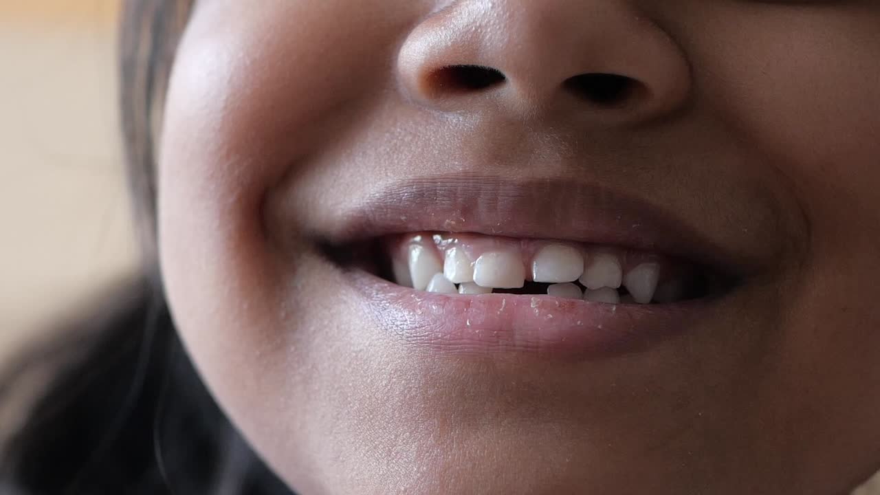 primer plano de la boca de un niño sonriente