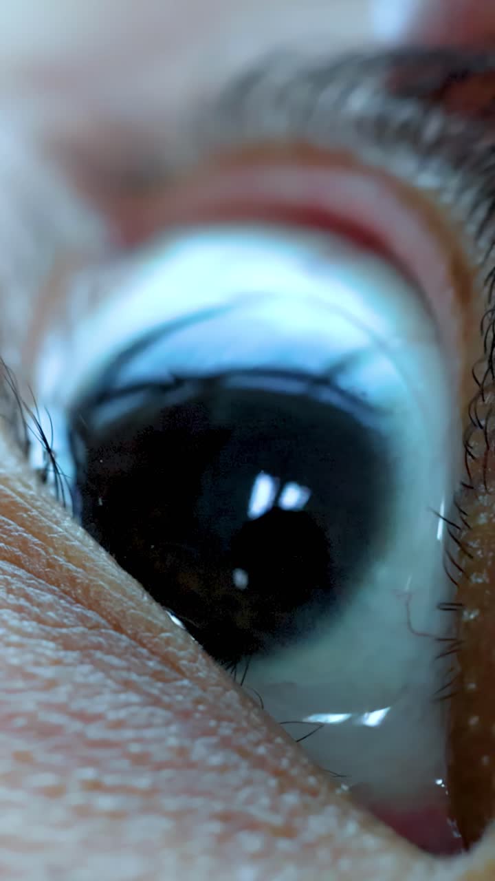 Macro slow-motion shot of human eye receiving lubricating drop, highlighting medical care and moisture