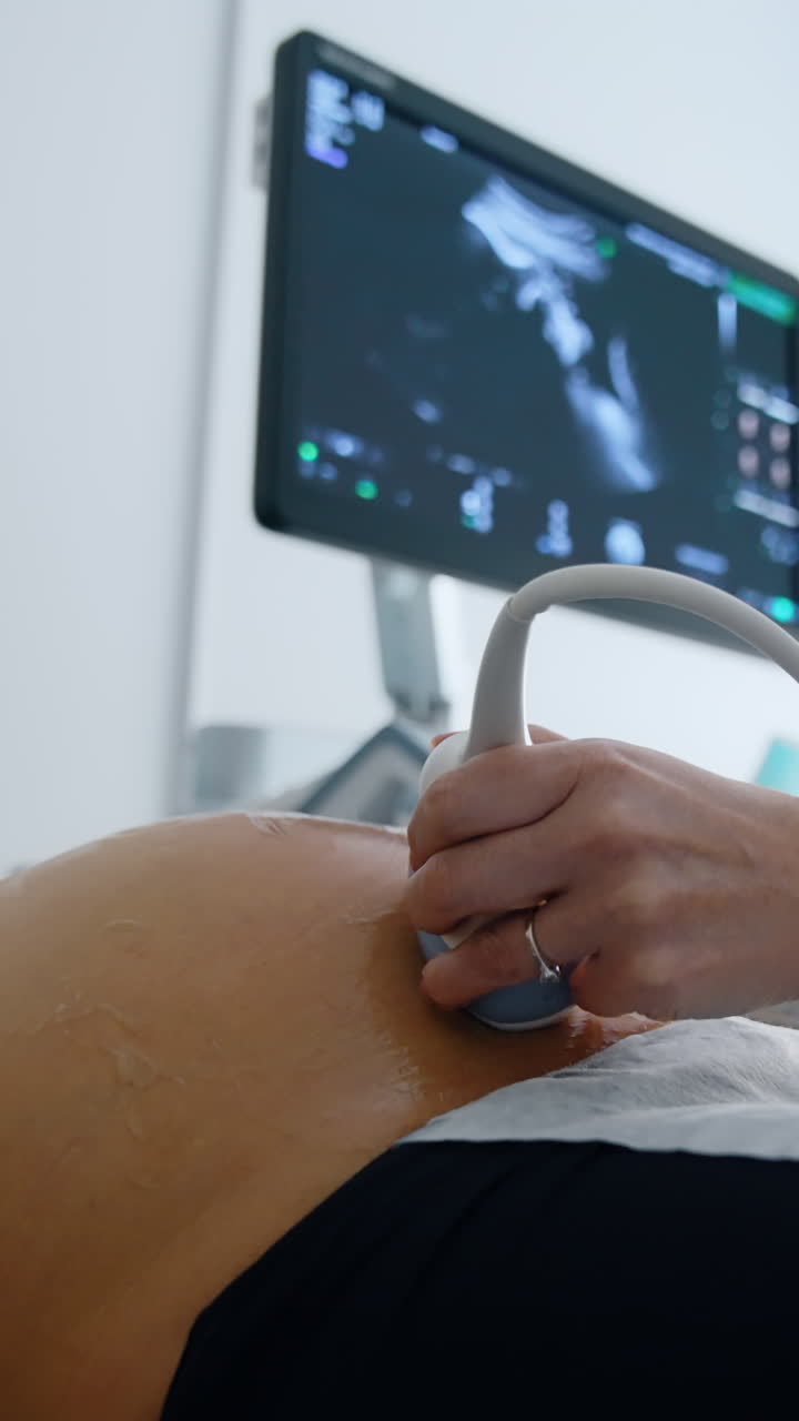 Modern hospital belly diagnostic. Sonogram pregnancy examining. Vertical video